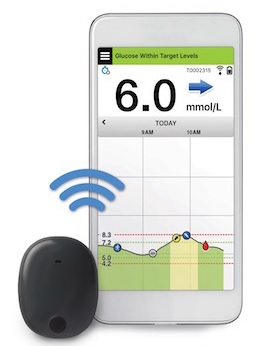 Continuous Glucose Monitoring systems